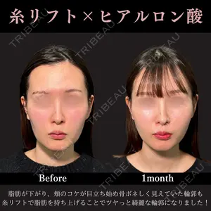 PRISM Beauty Clinic 畑山 知輝医師の症例