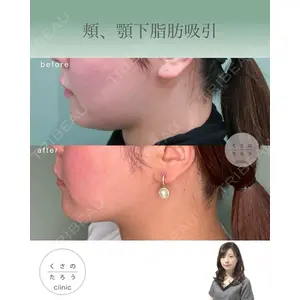 くさのたろうクリニックの症例