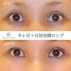 LOUIS CLINIC 二子玉川院【ルイクリニック】 小松 塁医師の症例