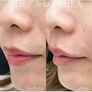 湘南美容クリニック 銀座院の症例