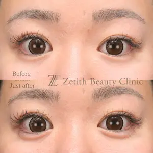 Zetith Beauty Clinic 福岡院 堂園 史子医師の症例