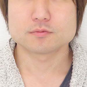 A CLINIC（エークリニック） 新宿院 山田 哲雄医師の症例