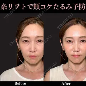 PRISM Beauty Clinic 畑山 知輝医師の症例