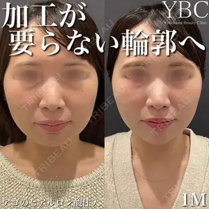 YBC横浜美容外科 大宮院 磯村 亮輔医師の症例