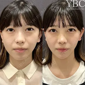 YBC横浜美容外科 大宮院 磯村 亮輔医師の症例