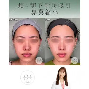 くさのたろうクリニックの症例