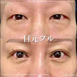 グローバルビューティークリニック 大阪院の症例