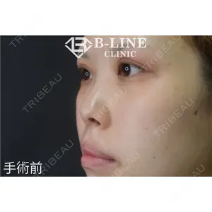 B-LINE CLINIC 池袋院 小池 康弘医師の症例