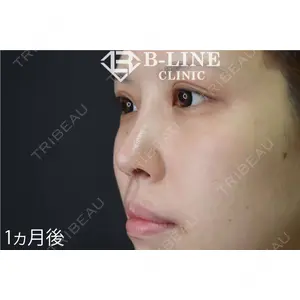 B-LINE CLINIC 池袋院 小池 康弘医師の症例