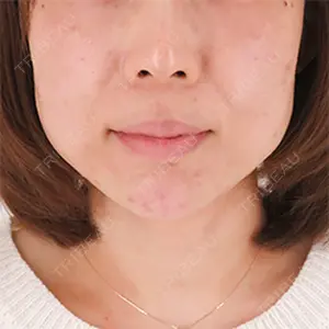 A CLINIC（エークリニック） 横浜院 柴田 貴志医師の症例