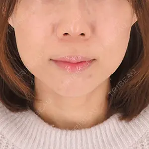 A CLINIC（エークリニック） 横浜院 柴田 貴志医師の症例