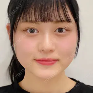 A CLINIC（エークリニック） 横浜院の症例
