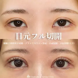 シンデレラ＆ダヴィンチクリニック 宮田 洋佑医師の症例