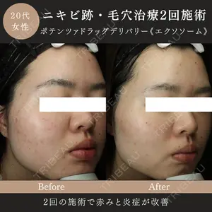 MIO CLINIC 梅田院の症例