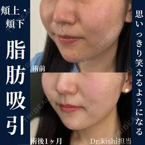 ネビュラクリニック 京都院 岸 大輔医師の症例
