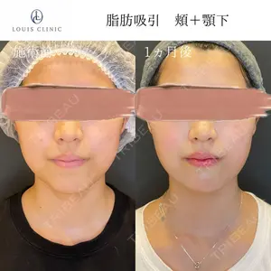 LOUIS CLINIC 二子玉川院【ルイクリニック】 小松 塁医師の症例