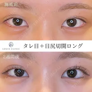 LOUIS CLINIC 二子玉川院【ルイクリニック】 小松 塁医師の症例