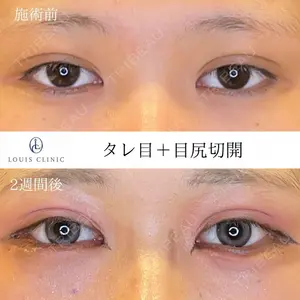 LOUIS CLINIC 二子玉川院【ルイクリニック】 小松 塁医師の症例