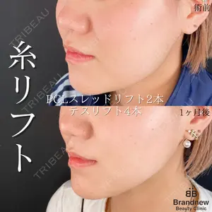 Brandnew Beauty Clinicの症例