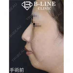 B-LINE CLINIC 池袋院 小池 康弘医師の症例