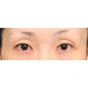 プリモ麻布十番クリニック 大場教弘医師の症例