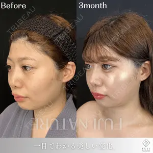 藤・ナチュレ美容クリニック 銀座院の症例