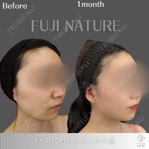 藤・ナチュレ美容クリニック 銀座院の症例