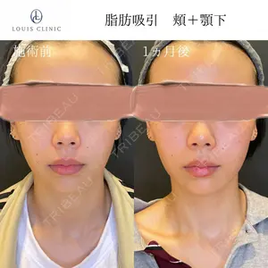 LOUIS CLINIC 二子玉川院【ルイクリニック】 小松 塁医師の症例