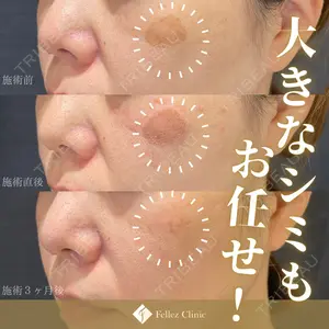 Fellez Clinic【フェルズクリニック】 小野 泰寛医師の症例