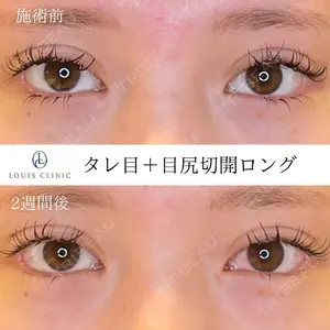 LOUIS CLINIC 二子玉川院【ルイクリニック】 小松 塁医師の症例