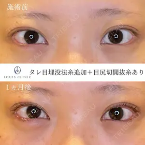 LOUIS CLINIC 二子玉川院【ルイクリニック】 小松 塁医師の症例