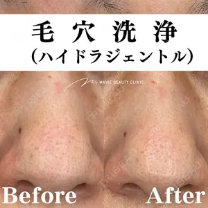 Mavie Beauty Clinic （マヴィービューティークリニック）の症例