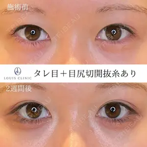 LOUIS CLINIC 二子玉川院【ルイクリニック】 小松 塁医師の症例