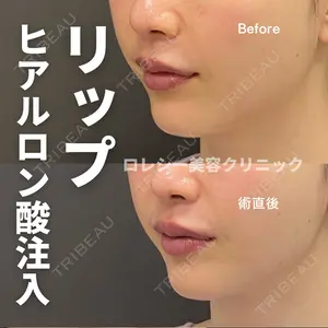 ロレシー美容クリニック 心斎橋駅前院 田中先生医師の症例
