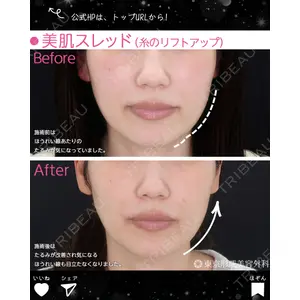 東京形成美容外科 銀座院 中尾 真紀医師の症例