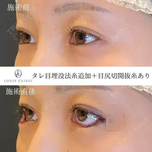 LOUIS CLINIC 二子玉川院【ルイクリニック】 小松 塁医師の症例