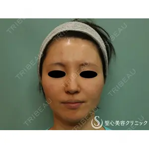 聖心美容クリニック 横浜院 佐々木 直美医師の症例