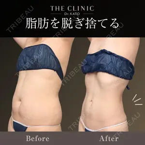 THE CLINIC（ザ・クリニック） 東京院 加藤 敏次医師の症例