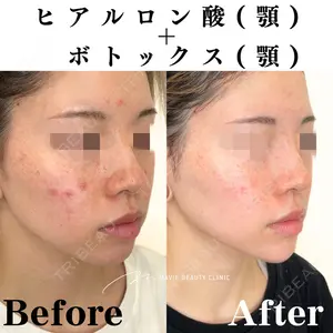 Mavie Beauty Clinic （マヴィービューティークリニック） 渡邉 憲一郎医師の症例