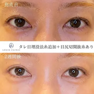 LOUIS CLINIC 二子玉川院【ルイクリニック】 小松 塁医師の症例