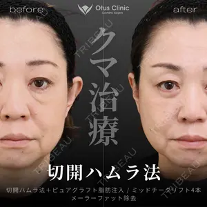 Otus Clinic 【オータスクリニック】 中 徳太郎医師の症例