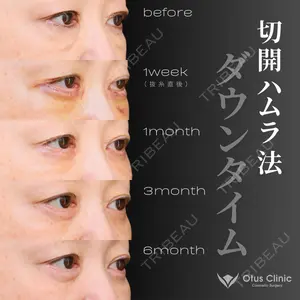 Otus Clinic 【オータスクリニック】 中 徳太郎医師の症例