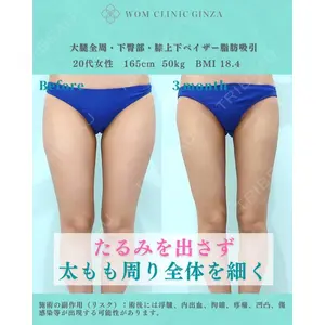 WOM CLINIC GINZA （ワム クリニック ギンザ） 佐々木 和司医師の症例