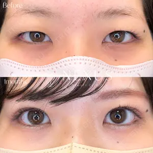 NEXUS CLINICの症例