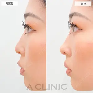 A CLINIC（エークリニック） 大阪院 田窪 賢志郎医師の症例
