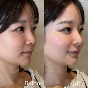 HAAB×DREAM BEAUTY CLINIC 東京本院 吉岡 修一医師の症例