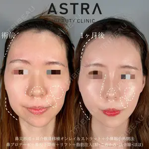 ASTRA BEAUTY CLINIC 塩満 惠子医師の症例