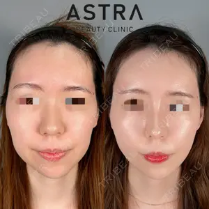 ASTRA BEAUTY CLINIC 塩満 惠子医師の症例