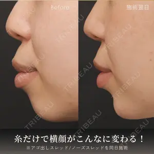 アモーレクリニック 名古屋院の症例