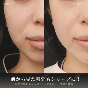 アモーレクリニック 名古屋院の症例